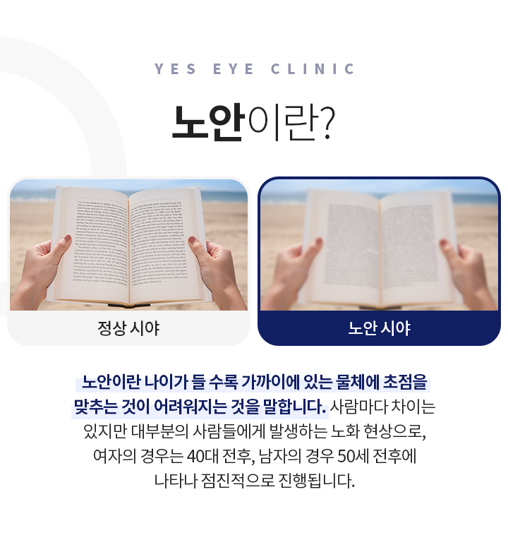 서브이미지
