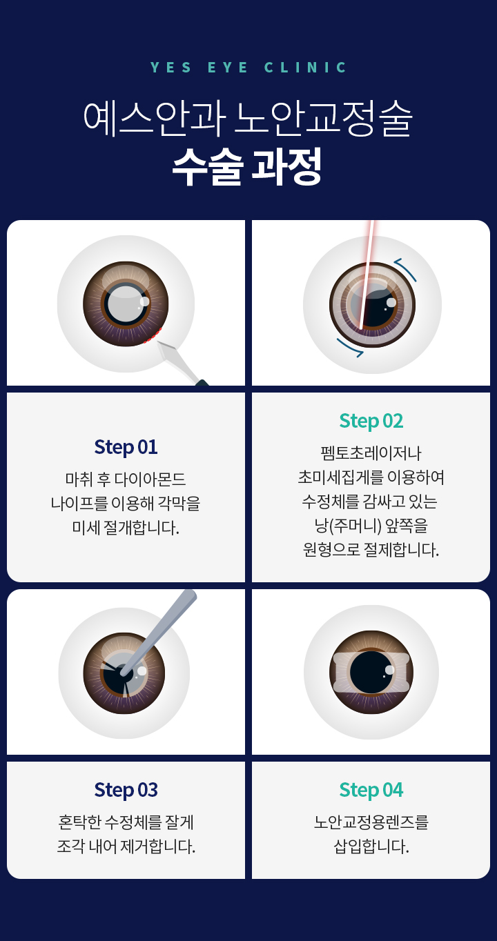 서브이미지