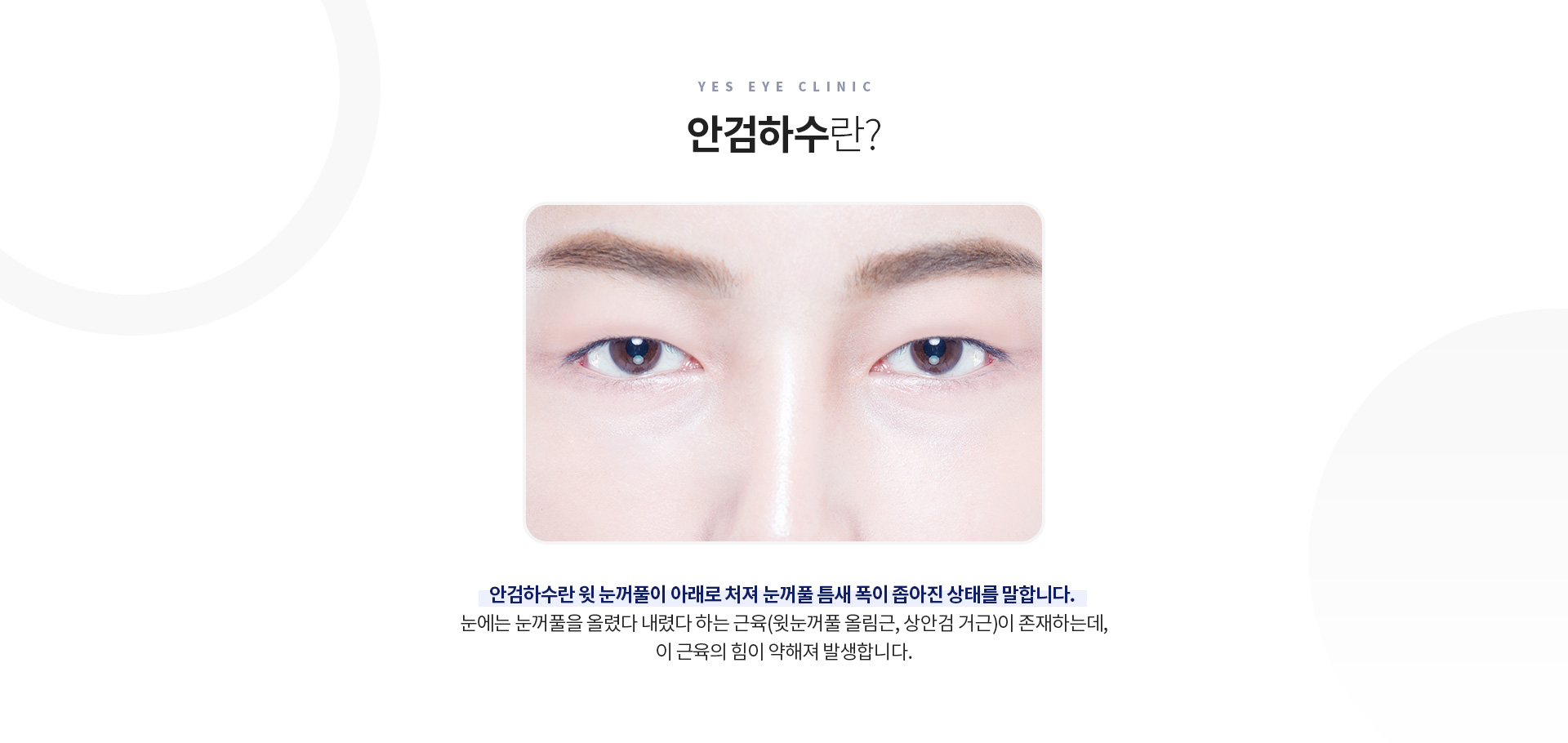 서브이미지