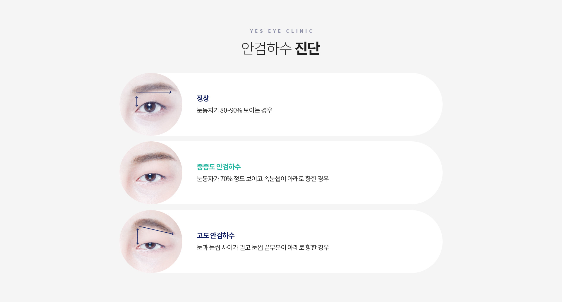 서브이미지