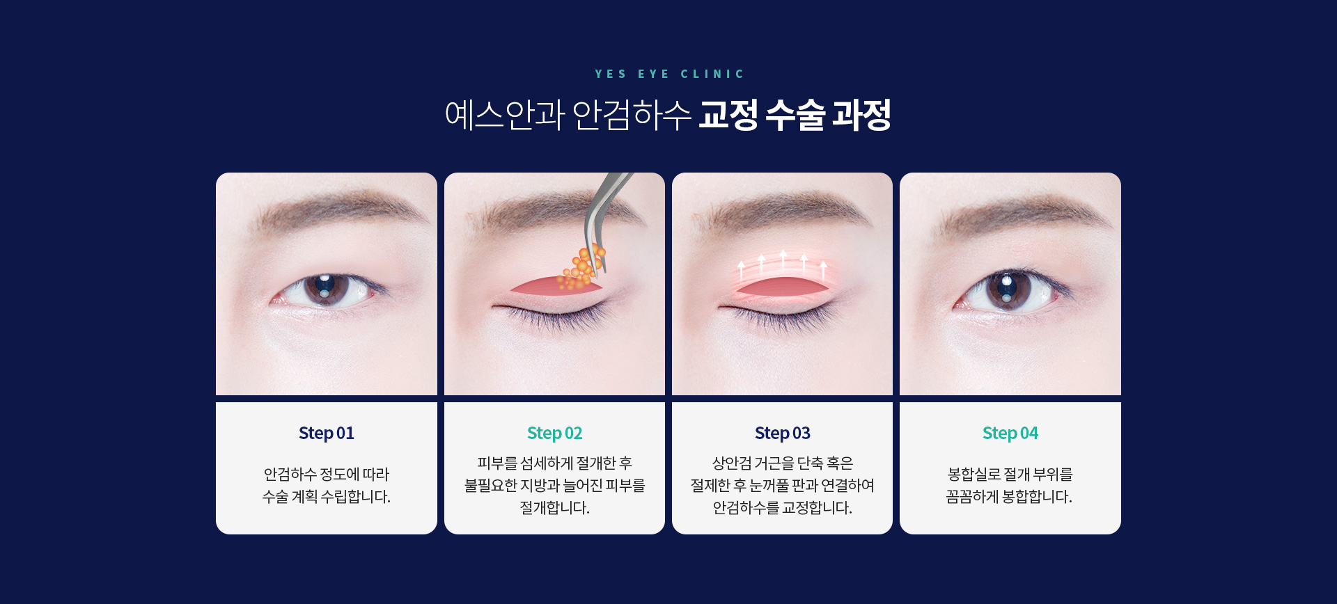 서브이미지