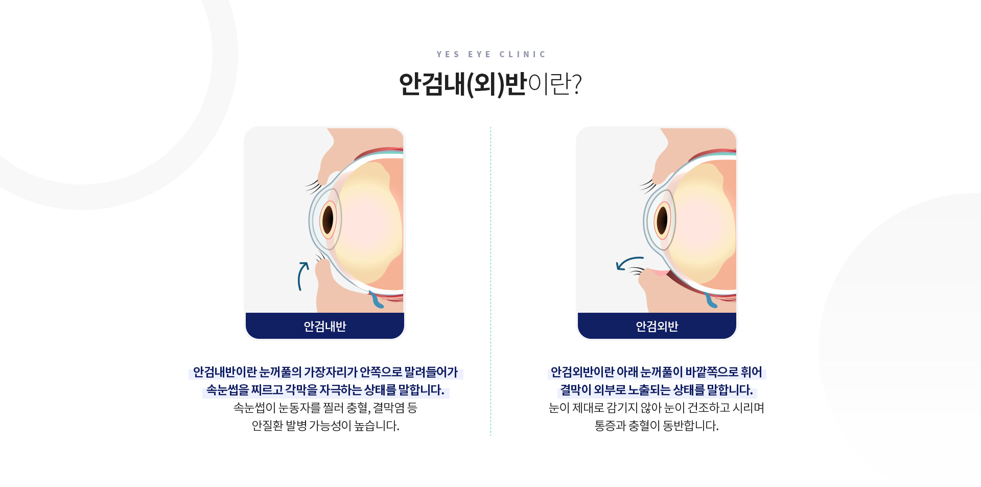 서브이미지