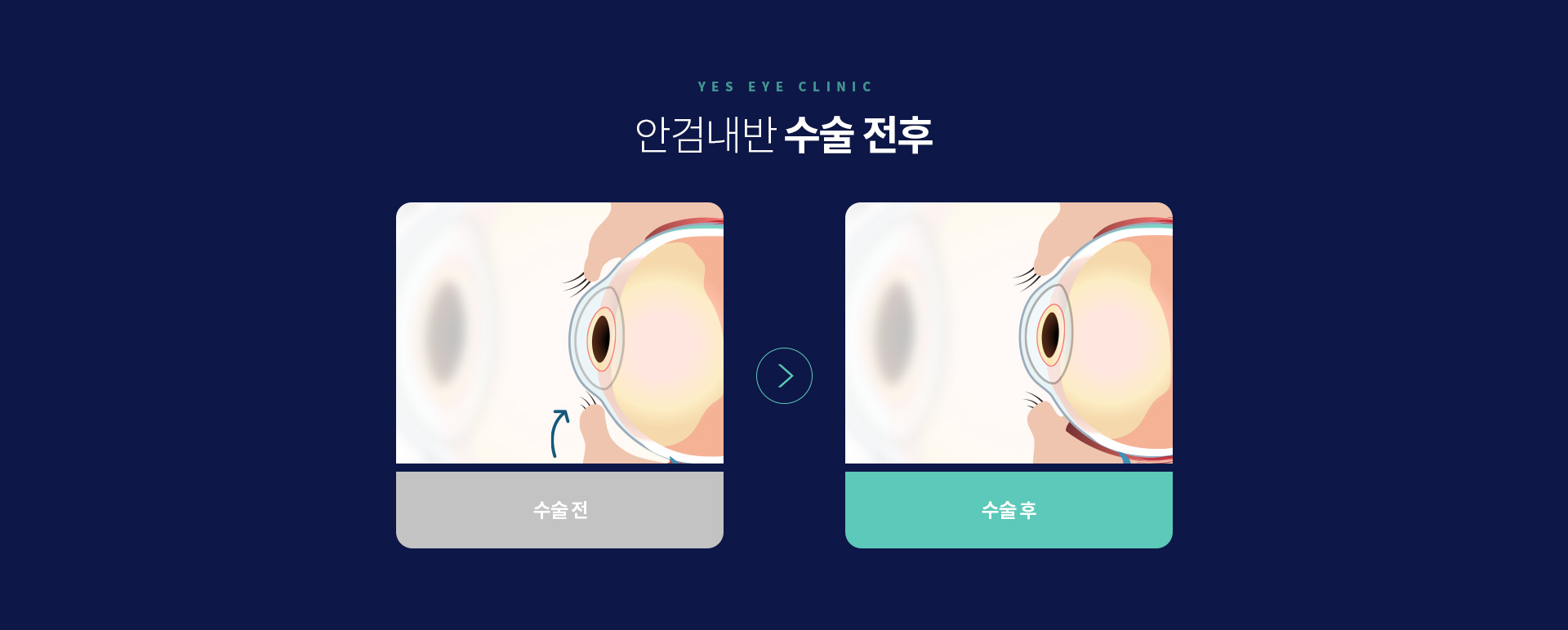 서브이미지