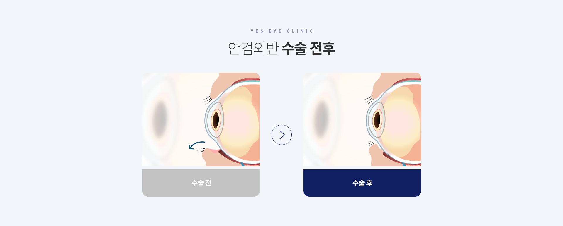 서브이미지