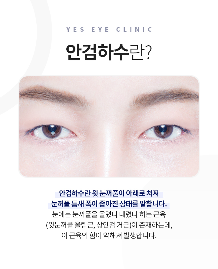 서브이미지