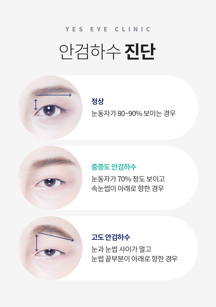 서브이미지