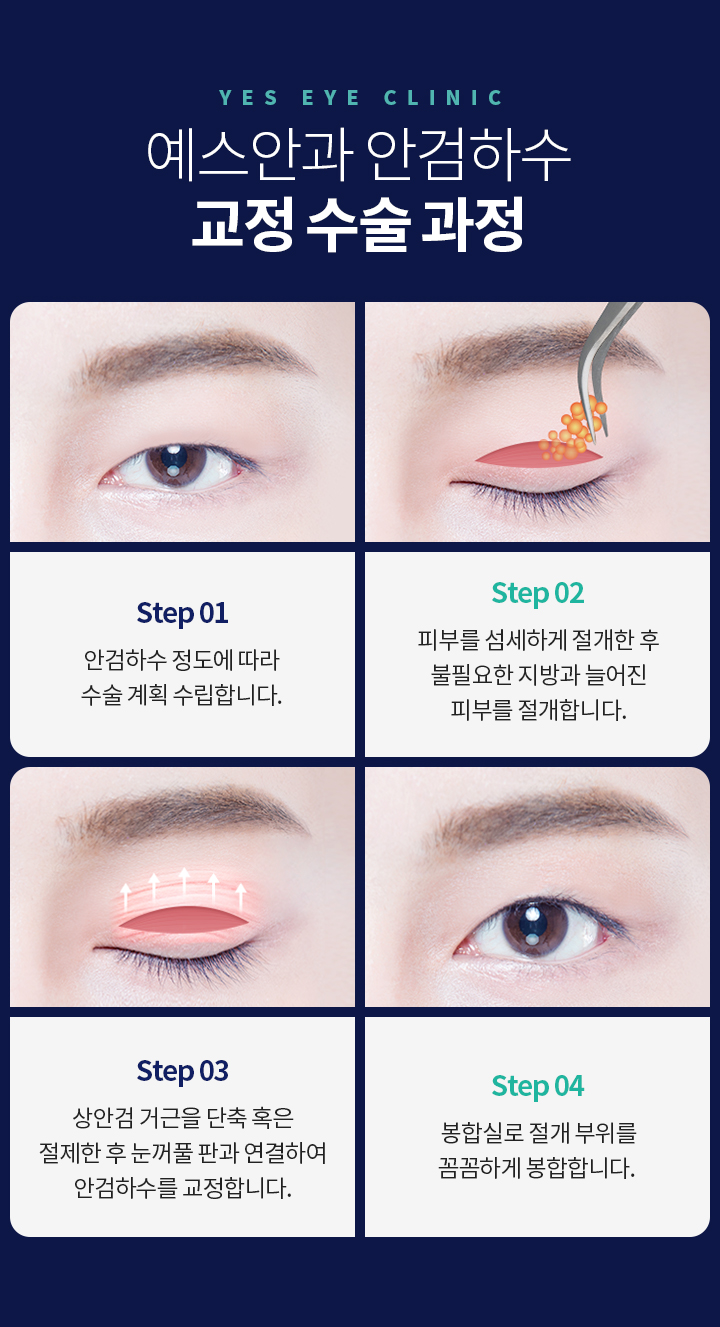 서브이미지