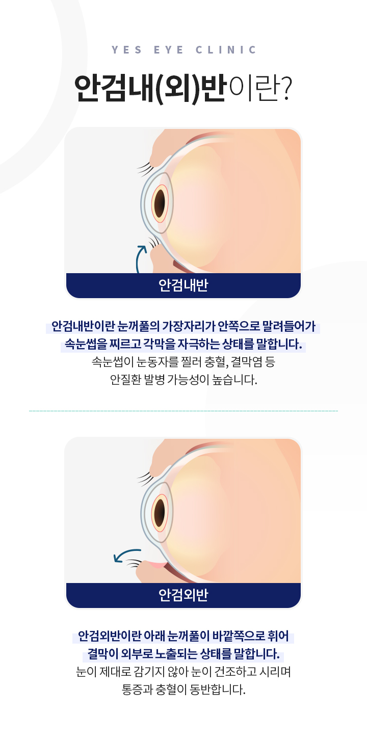 서브이미지