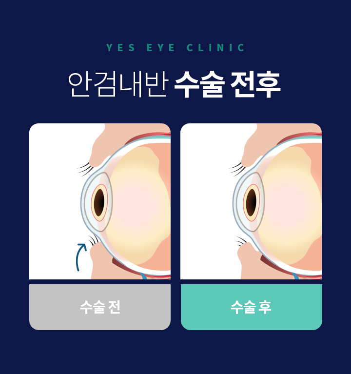 서브이미지
