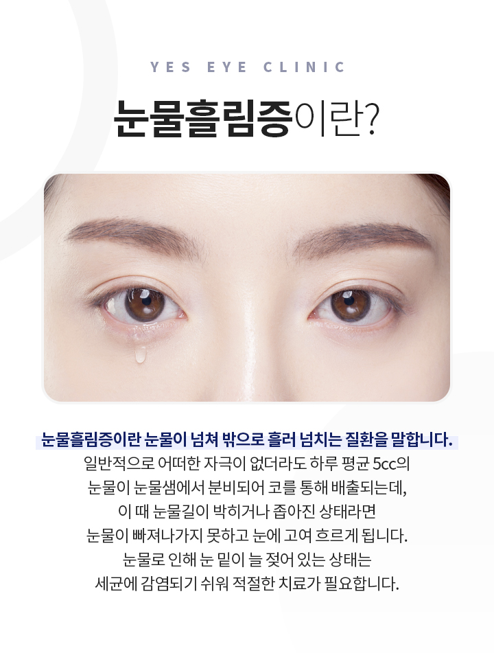 서브이미지