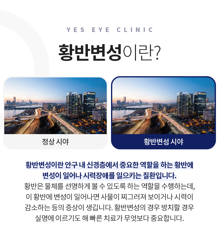 서브이미지