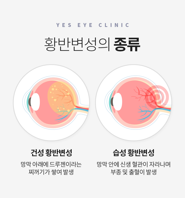 서브이미지