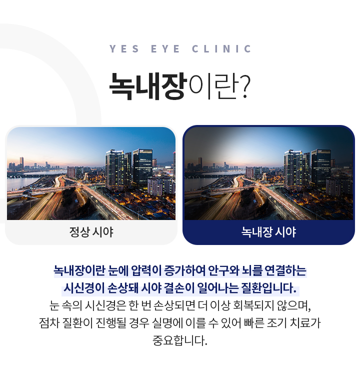 서브이미지