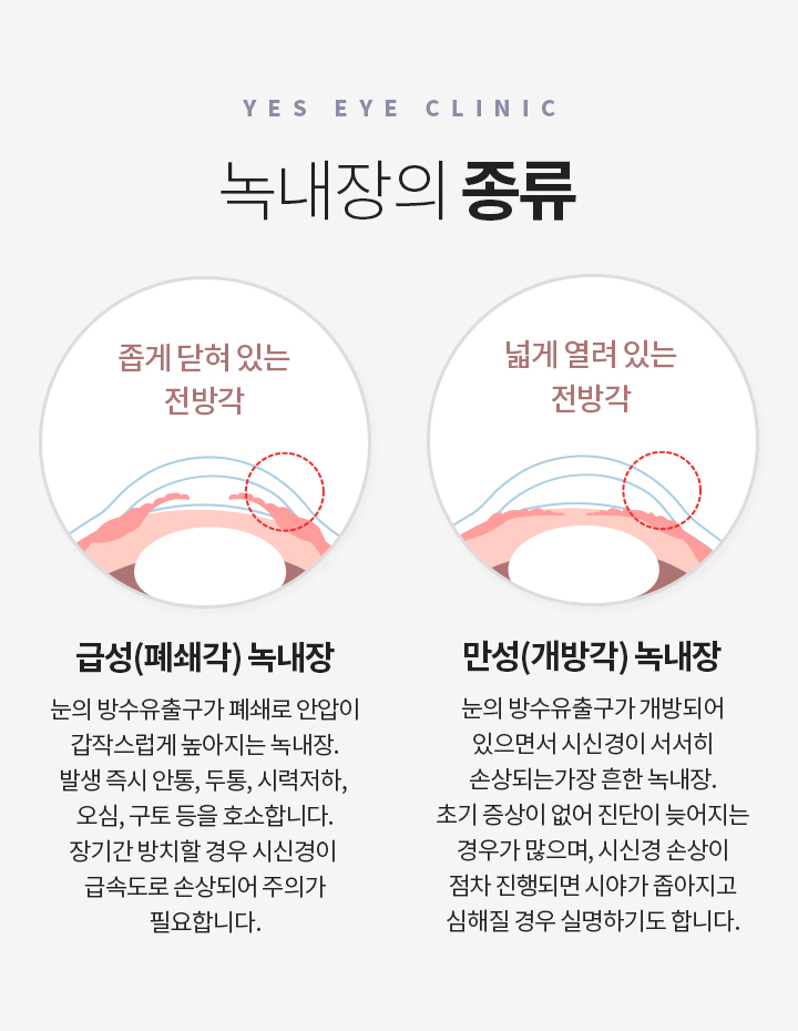 서브이미지