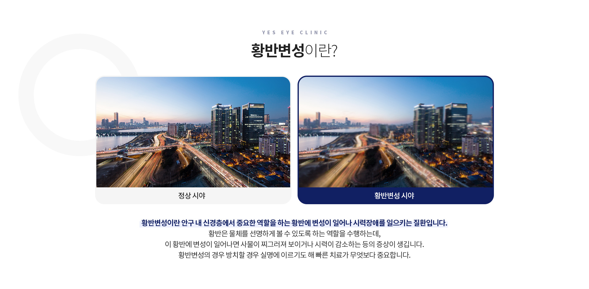 서브이미지