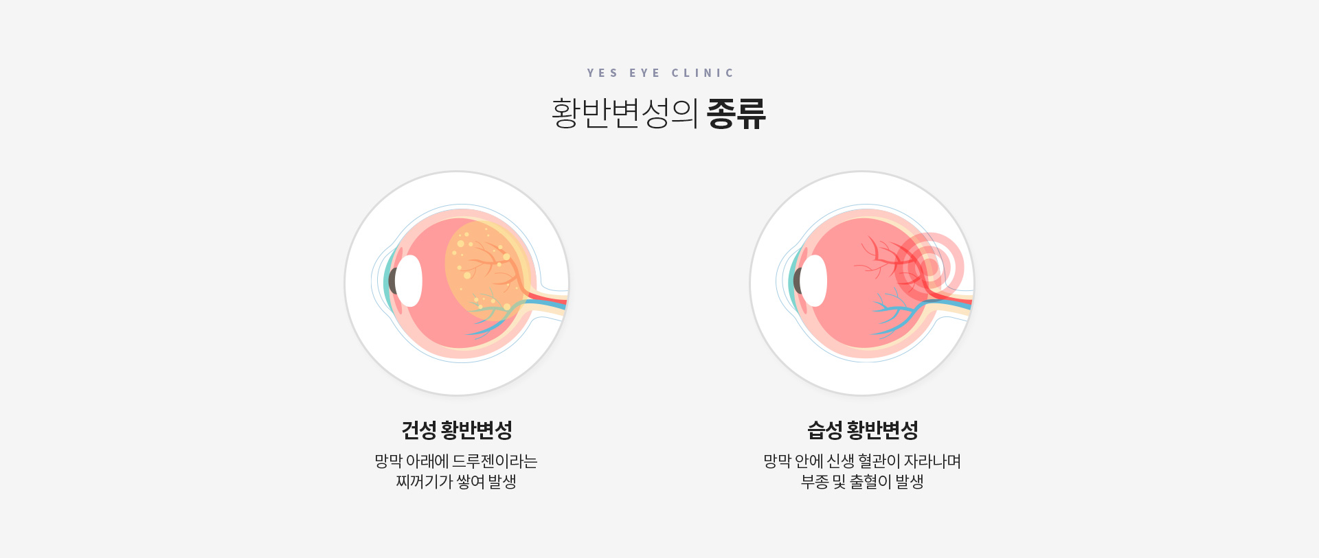 서브이미지