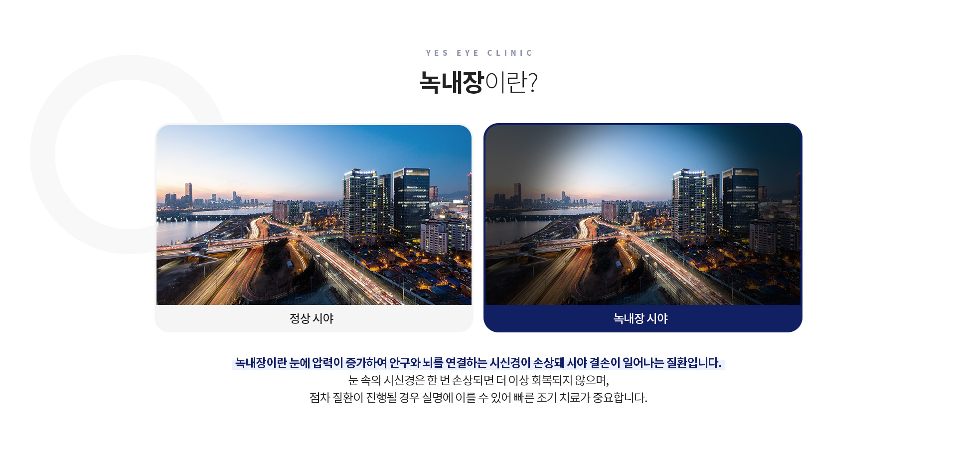 서브이미지