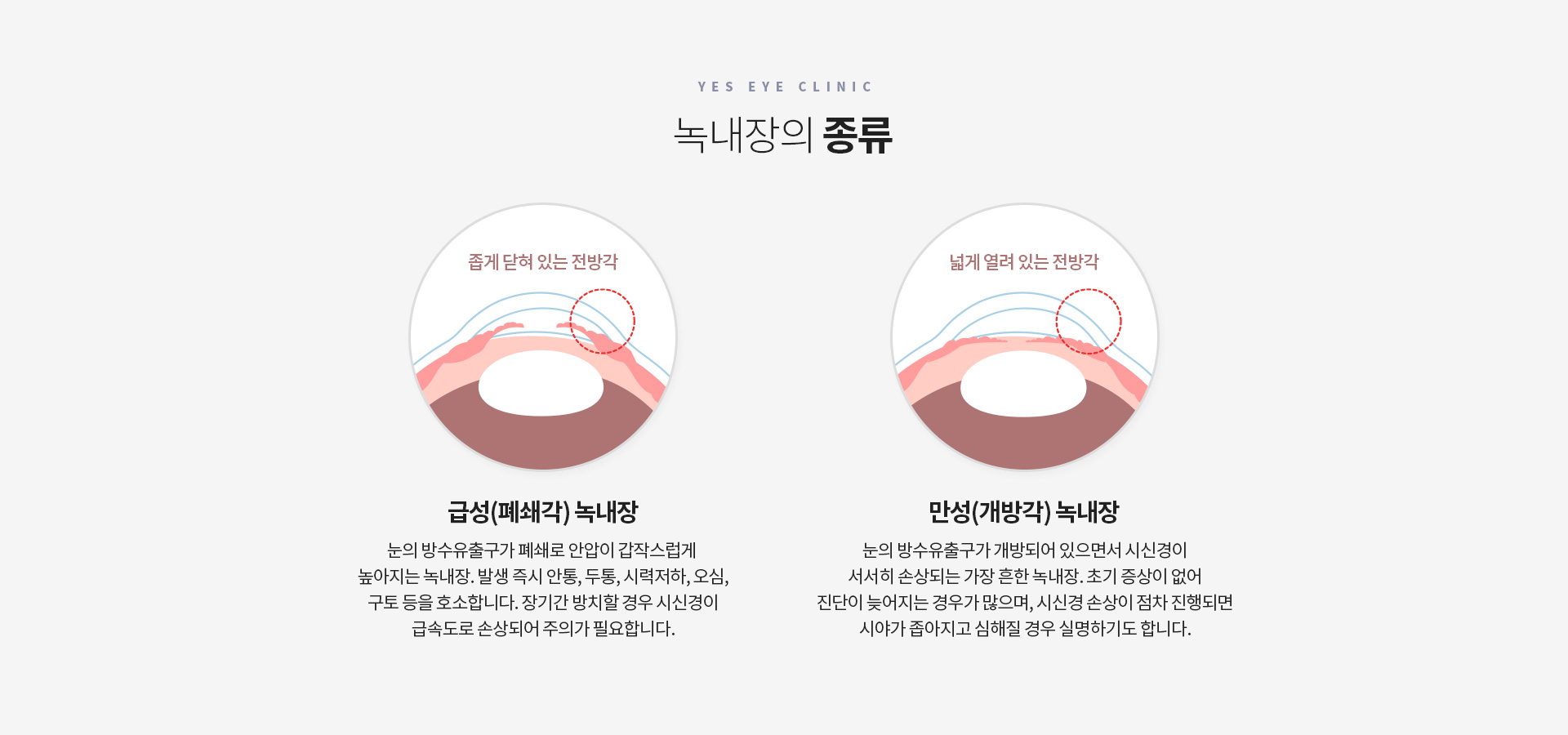 서브이미지